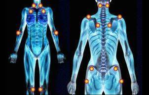 Dureri de spate si oboseala constanta? Ai putea suferi de fibromialgie! Iata toate simptomele si tratamentul