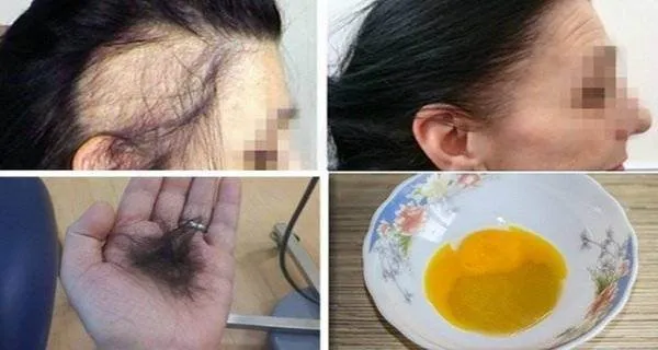 A oprit caderea parului IMEDIAT cu ajutorul unui preparat facut in casa