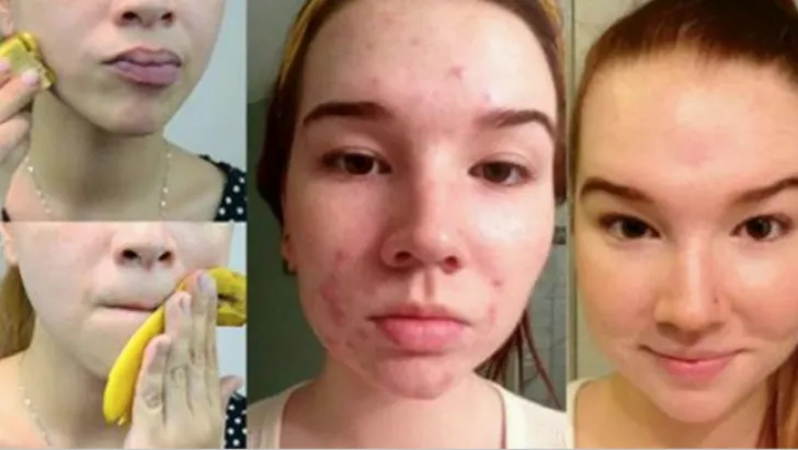 Aruncati cojile de banana? 5 lucruri surprinzatoare in care le puteti folosi