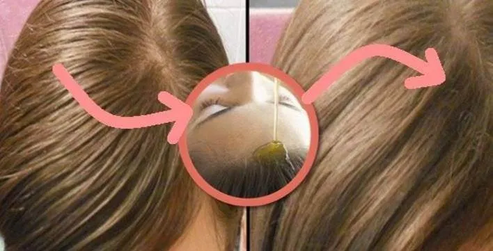 Afla cum poti scapa de parul gras cu ajutorul acestei solutii 100% naturale