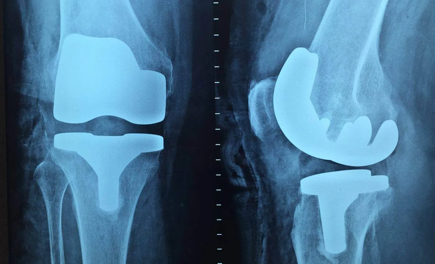 4 lucruri pe care le fac barbatii si isi distrug incheieturile
