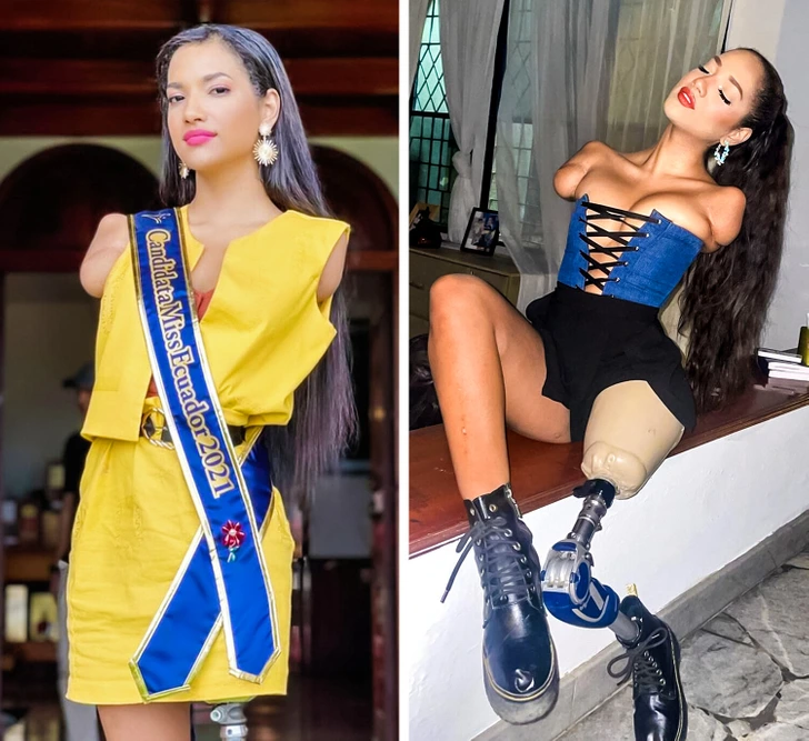 „Sunt un model sexy și nimic nu mă oprește!” O femeie cu triplă amputare a devenit Miss Ecuador și vedetă de televiziune
