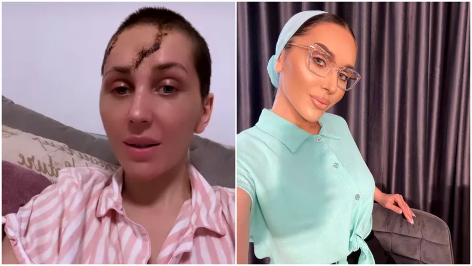 Dana Roba și-a arătat și operația din spatele capului – ți se face pielea de găină!