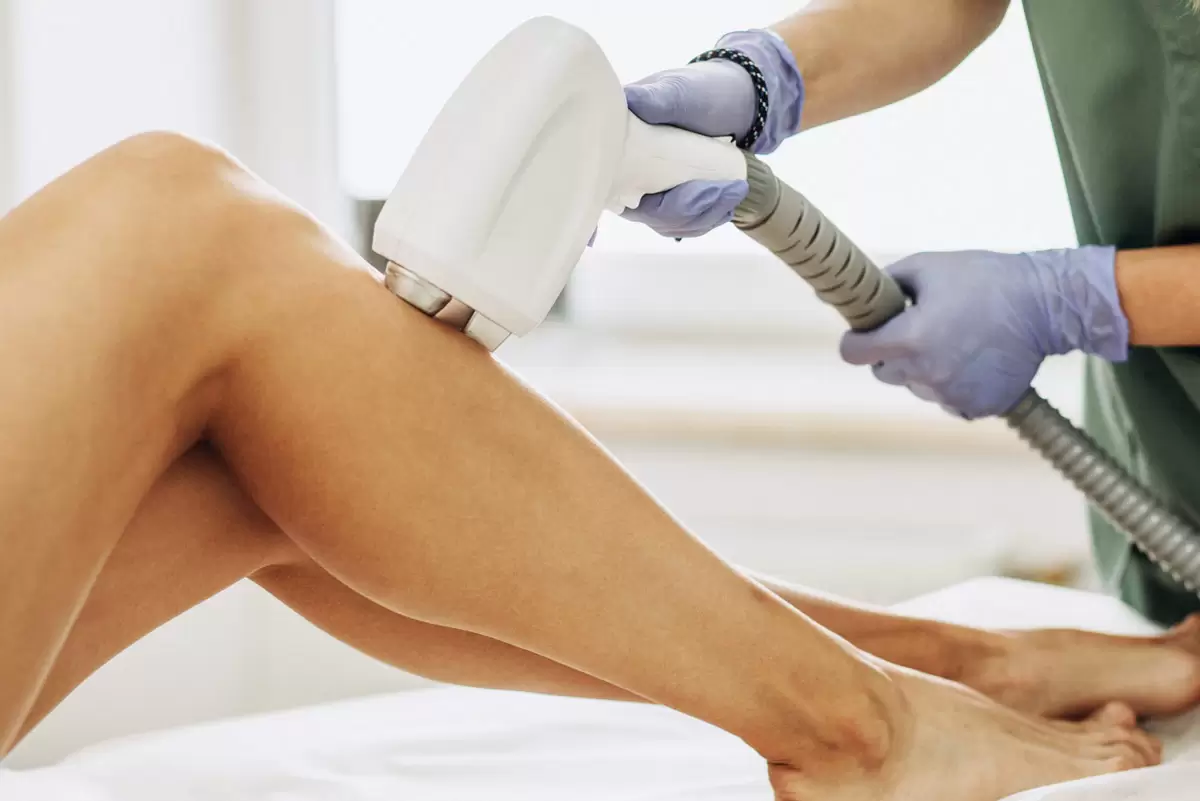 Epilarea cu laser de la A la Z. Tot ceea ce trebuie sa stii