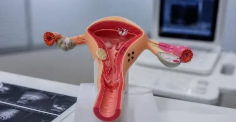Ce câștigi din noul studiu despre adenomioză. Tratamente mai blânde care pot evita histerectomia