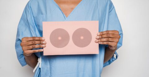 Ce modificări la sân cer consult chiar fără nodul și când faci mamografia recomandată între 50 și 69 de ani